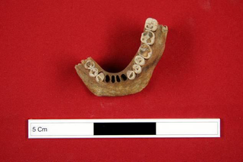 Fig 6.2 Tooth wear was one of the methods used to establish the age of the individual from inhumation burial EL76AL (FN 321) (Elsham)